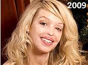 katie-piper-2009.jpg